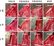 끊어진 말초신경을 재생시켰다