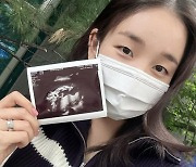 가수 백아연, 엄마 된다 "임신 5개월" [공식]
