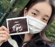 백아연, 임신 5개월 발표…"딸이에요. 태명은 용용이"
