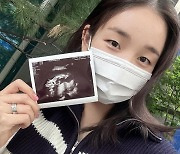 백아연, 임신 소식 전해 “용띠 딸 엄마됩니다” [공식]