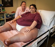 “너무 커서”…318kg ‘가장 무거운 남성’ 사망후 장례조차 치르지 못해