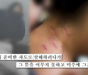 미용업체 흉기난동 사건, 불청객은 왜 손님에게 칼을 휘둘렀나…'궁금한이야기Y' 추적