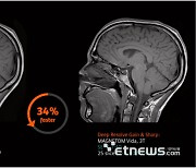 CT·MRI 등 의료기기와 AI 접목 확대…의료AI 경쟁 격화