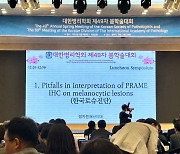 한국로슈진단, 대한병리학회 학술대회에서 새로운 피부암 진단마커 프레임 항체 소개