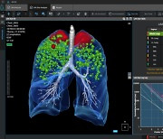 코어라인소프트, 美흉부학회서 AI 솔루션 시연