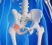 65세 넘어서 ‘이곳’ 부러지면… 암보다 사망 위험 높아