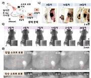 “체내서 임무 수행후 소멸” 마이크로 의료로봇 개발