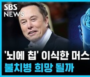 '뇌에 칩' 이식한 머스크, 불치병 희망 될까 [뽀얀거탑]