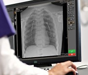 Carestream Introduces Image Suite MR 10 Software to Enhance Imaging Experience for CR and DR Imaging Systems