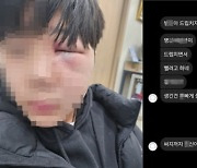 망막 훼손되고 '실명' 위기···"사과도 없었다" 학폭 피해 학생의 절규