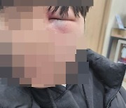 입학하자마자 학폭으로 실명 위기…"가해학생 '옆 반'서 버젓이 욕설"