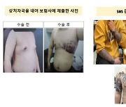 "조폭 브로커 동원"…허위수술로 12억 챙긴 의사, 펜타닐까지 투약