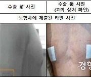 여유증·다한증 수술한다 속여 12억원 챙긴 조폭·병원 관계자 덜미