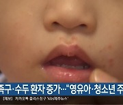 제주 수족구·수두 환자 증가…“영유아·청소년 주의”