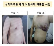 "칼로 가슴 살짝만 째면 돈준다" MZ조폭 뛰어든 보험사기…의료진도 한 패였다