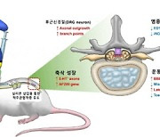 "척추관협착증으로 손상된 신경, 약침으로 치료한다"