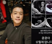 류시원, ‘♥︎19살 연하 아내’ 임신 고백→초음파 공개..“쿵쿵아 겨울에 만나자”