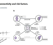 英 연구팀 "뇌 활동 10분 스캔하면 치매 최대 9년 전에 예측 가능"[통신One]