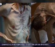 [이 시각 세계] '뼈만 남은 앙상한 몸'‥2년 만에 돌아온 우크라 포로