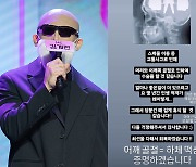 김계란, 교통사고로 수술 앞둬 “머리·어깨 골절”