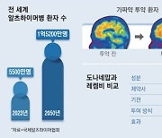 '머릿속 지우개' 알츠하이머 60% 늦추는 신약 온다