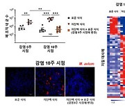 비결핵 항산균 폐질환 환자 질병 악화 메커니즘 규명