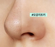 바르면 ‘깐달걀’ 피부 된다는 피지연화제, 효과 있나요? [건강+]