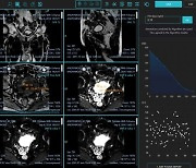 제이엘케이의 전립선암 진단 AI솔루션, 美 FDA 승인