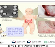 수족구병, 최근 한 달간 2배 급증…"영유아 보육시설 위생관리 철저해야"