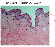 “순금 화장품 바르고 자외선 쬈더니, 콜라겐 생성” 연구결과 나왔다