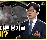 [약손+] 불치를 넘어 완치로! '뇌종양의 진단과 치료' ②뇌종양, 다른 장기로 전이는?