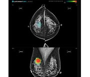 [게시판] 루닛, 강북삼성병원에 AI 유방암 검진 설루션 공급