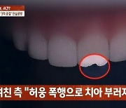 “허웅, 때려 치아 부러져…강제 성관계” 전 여자친구 주장