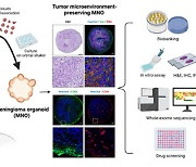 뇌수막종 환자 세포 유래 오가노이드, 국내 첫 개발