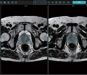 제이엘케이, 전립선암 진단 AI 솔루션 특허 획득