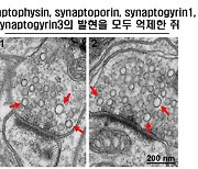 뇌 속 신경전달물질 주머니 크기 조절인자 최초 발견