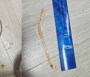 [뉴스딱] 삼겹살 먹다 '컥'…"뱉어보니 하얗고 길쭉" 8cm 물체 충격