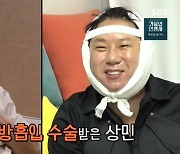 이상민 "턱밑 지방흡입 만족, 라인 살아나…셀럽들 관리 이유 알겠다"