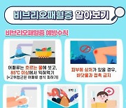 부천시, 여름철 ‘비브리오패혈증 조심’ 당부