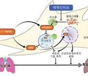 특발성 폐섬유증, 콜레스테롤 약제 치료 효과 확인