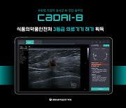 빔웍스, 유방암 초음파 실시간 AI 진단 솔루션 'CadAI-B' 식약처 허가