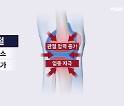 "비 오면 더 쑤시고 아파"…방치 땐 무릎 못 펴는 관절염