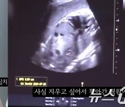 "36주 태아 낙태女, 처벌 곤란…'헌법 불합치' 적용할 법 없다" 변호사 주장