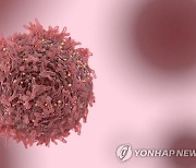 [금융 多있소] “암 전이된 것도 힘든데 치료비 부담에 속 곪아가셨다면"...'이 보험'으로 암치료비서 해방되세요