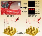 96% 높은 정확도로 암 유전자 `콕`…암 조기 진단 재발 모니터링 활용