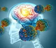 알츠하이머성 치매, 더 일찍 발견한다… 뇌 백질이 '히든카드'