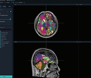 뷰노, AI 뇌 분석 의료기기 ‘뷰노메드 딥브레인’ 美 출시