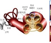 달팽이관 닮은 음향 센서 개발…차량 종류까지 구별