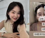 하늘, 출산 두 달만 코 재수술 "비수면 끔찍, 애 낳는 게 나아"