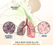 대웅제약 "IDMC서 특발성 폐섬유증 신약 지속 개발 권고"